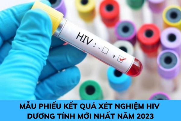 Mẫu giấy xét nghiệm HIV mới nhất được quy định như thế nào?
