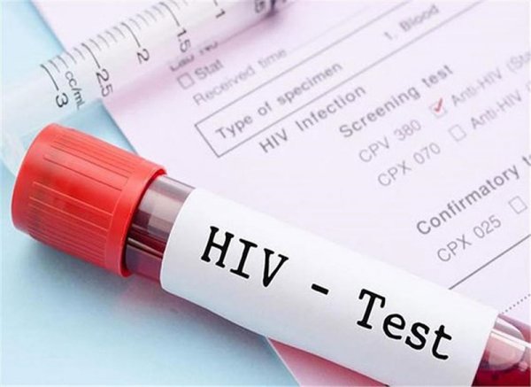 Sở Y tế tỉnh có trách nhiệm gì trong báo cáo công tác phòng, chống HIV/AIDS, 03/2015/TT-BYT