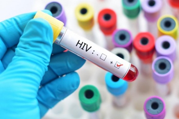 Trung tâm phòng, chống HIV/AIDS tỉnh phải giúp SYT kiểm tra, giám sát, 03/2015/TT-BYT