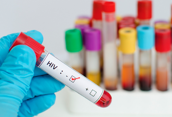Đối tượng ưu tiên giám sát phát hiện nhiễm HIV