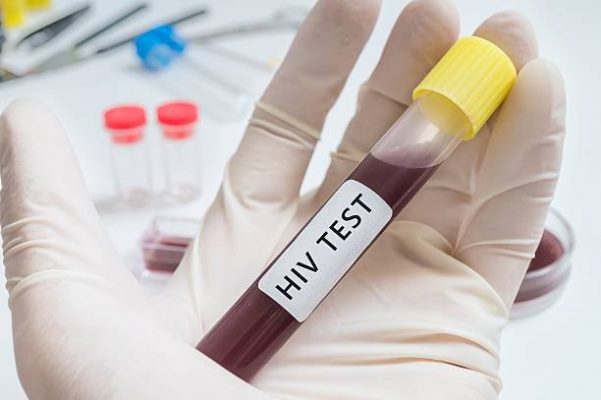 Process  of  Notifying  Positive  HIV  Test  Results  to  Individuals  Tested  for  HIV  Seeking  Medical  Examination  at  Medical  Facilities